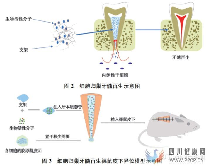 牙髓干细胞应用进展摘取(图3) 牙髓干细胞应用进展摘取(图3)