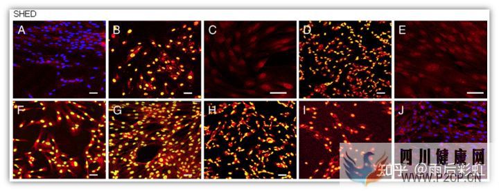 牙髓干细胞应用进展摘取(图8) 牙髓干细胞应用进展摘取(图8)