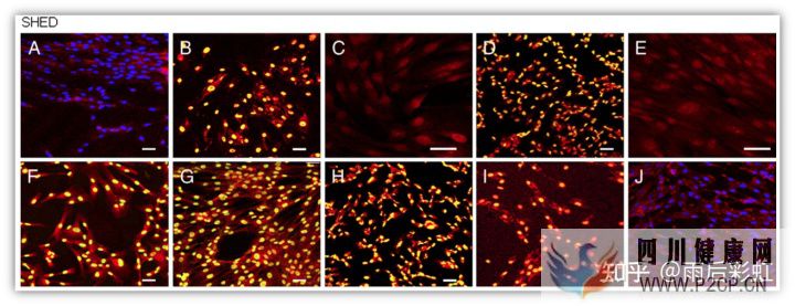 牙髓干细胞应用进展摘取(图7) 牙髓干细胞应用进展摘取(图7)