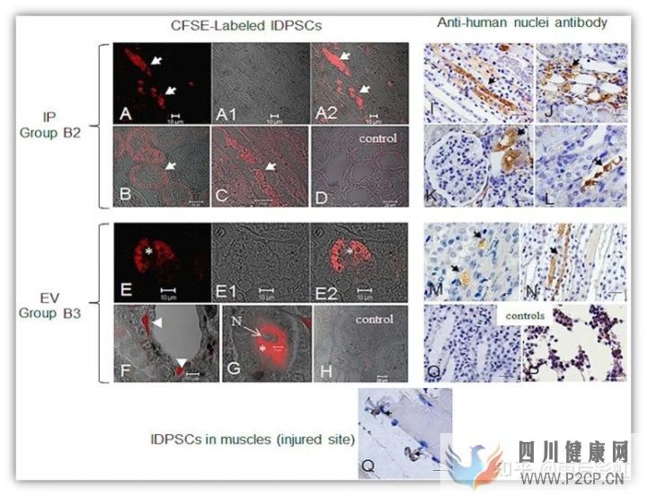 牙髓干细胞应用进展摘取(图9) 牙髓干细胞应用进展摘取(图9)