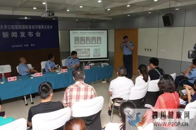 首创牙髓再生术,创造了乳牙干细胞的新里程碑(图9) 首创牙髓再生术,创造了乳牙干细胞的新里程碑(图9)