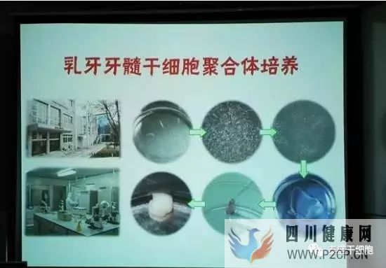 首创牙髓再生术,创造了乳牙干细胞的新里程碑(图11) 首创牙髓再生术,创造了乳牙干细胞的新里程碑(图11)