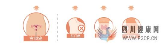 宫颈癌发病呈年轻化趋势？请收好预防指南(图2)