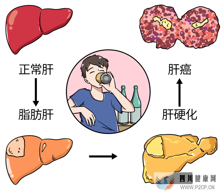 长期喝白酒能延年益寿,预防肿瘤?(图1) 长期喝白酒能延年益寿,预防肿瘤?(图1)