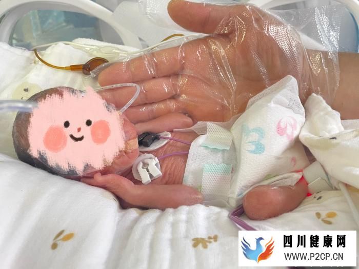 安徽600余克低体重试管双胞胎闯过“呼吸关”(图1) 安徽600余克低体重试管双胞胎闯过“呼吸关”(图1)